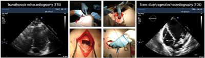 <mark class="highlighted">Necropsy</mark> Validation of a Novel Method for Left Ventricular Mass Quantification in Porcine Transthoracic and Transdiaphragmal Echocardiography